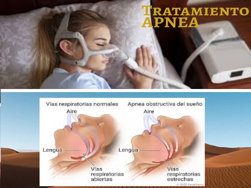 IMAGEN APNEA
